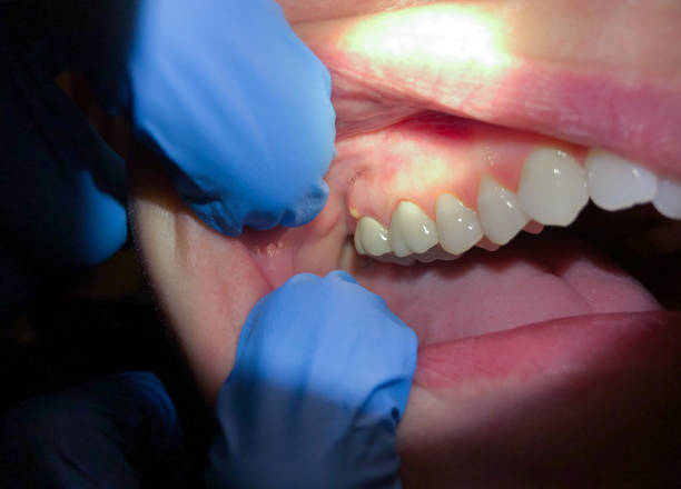 Best Root Canal Emergency Dentist  in Hampden Sydney, VA