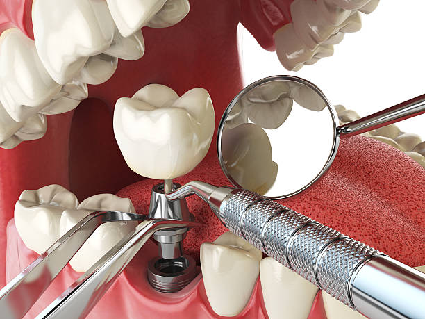 Best Cracked Tooth Emergency Dentist  in Hampden Sydney, VA